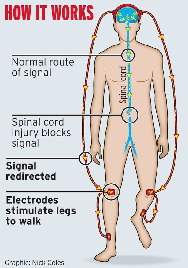 brain-walk-graphic