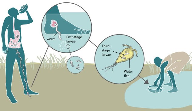 Guinea-worm1